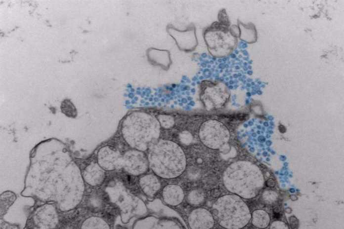 rhinovirus asthma